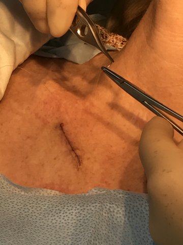 Surgical Dermatology Stitching